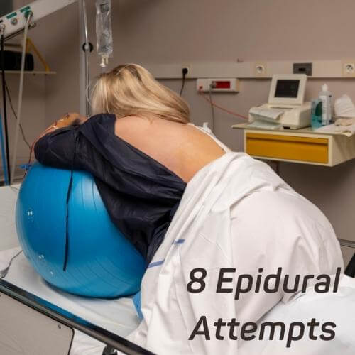 epidural problems
