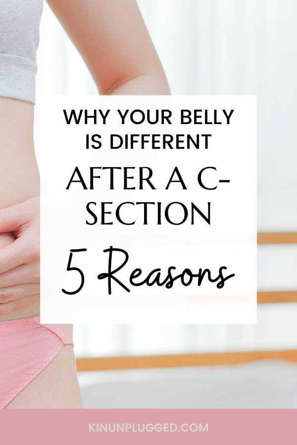 Comparing Stomach Changes: C-Section vs. Natural Birth - What to Expect ...